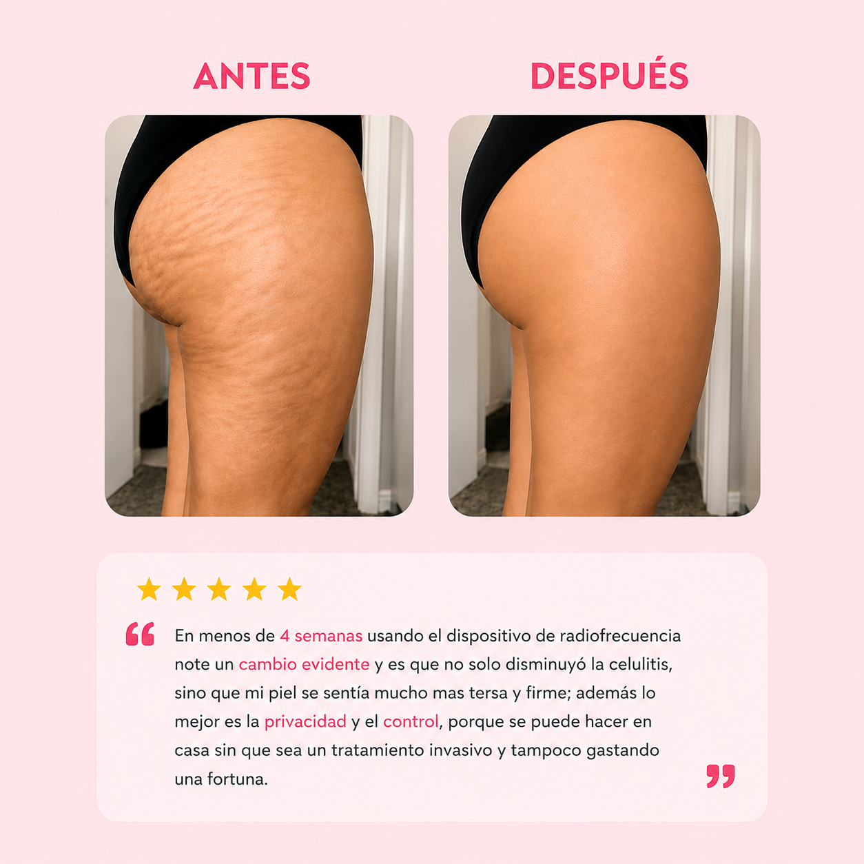 Dispositivo Radiofrecuencia | Reduce celulitis unifica y da firmeza a la Piel