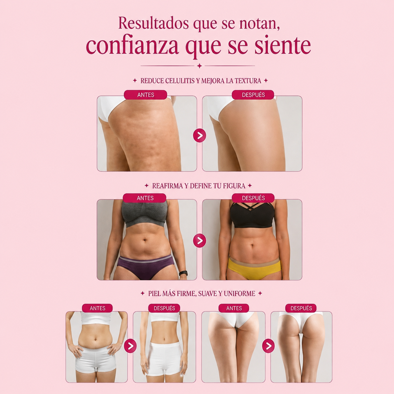 Dispositivo Radiofrecuencia | Reduce celulitis unifica y da firmeza a la Piel